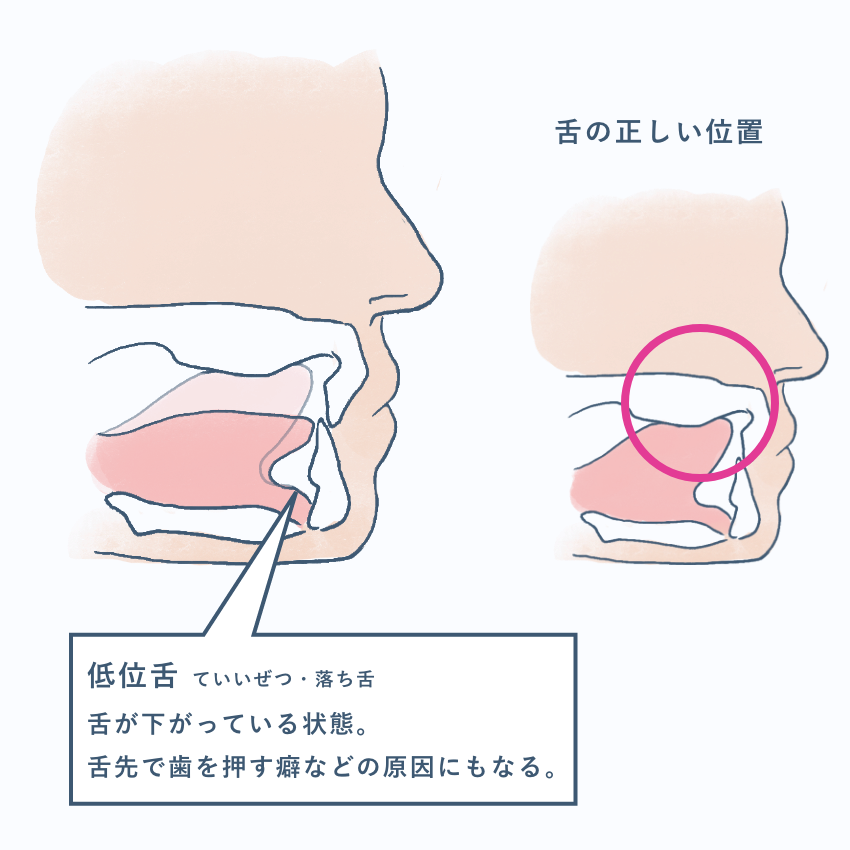 ほうれい線